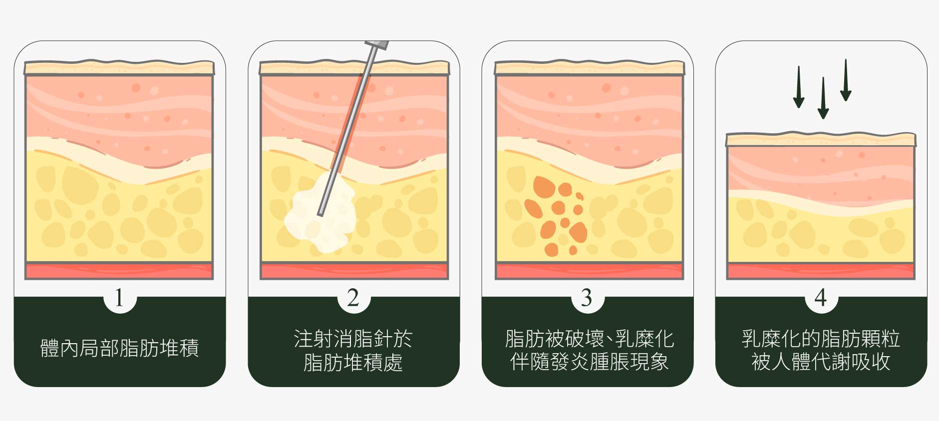 倍克脂細胞作用過程