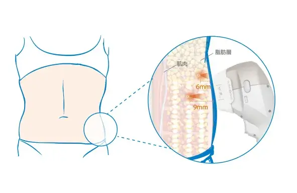 海芙音波作用原理-身體深度