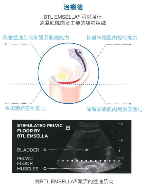 治療前與治療後比較圖-治療後