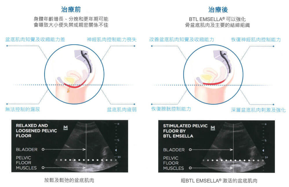 治療前與治療後比較圖