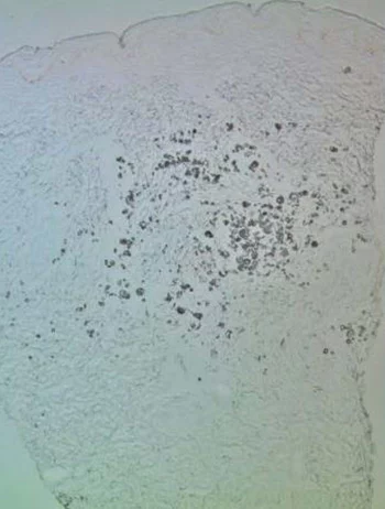 粒子在真皮層的作用圖