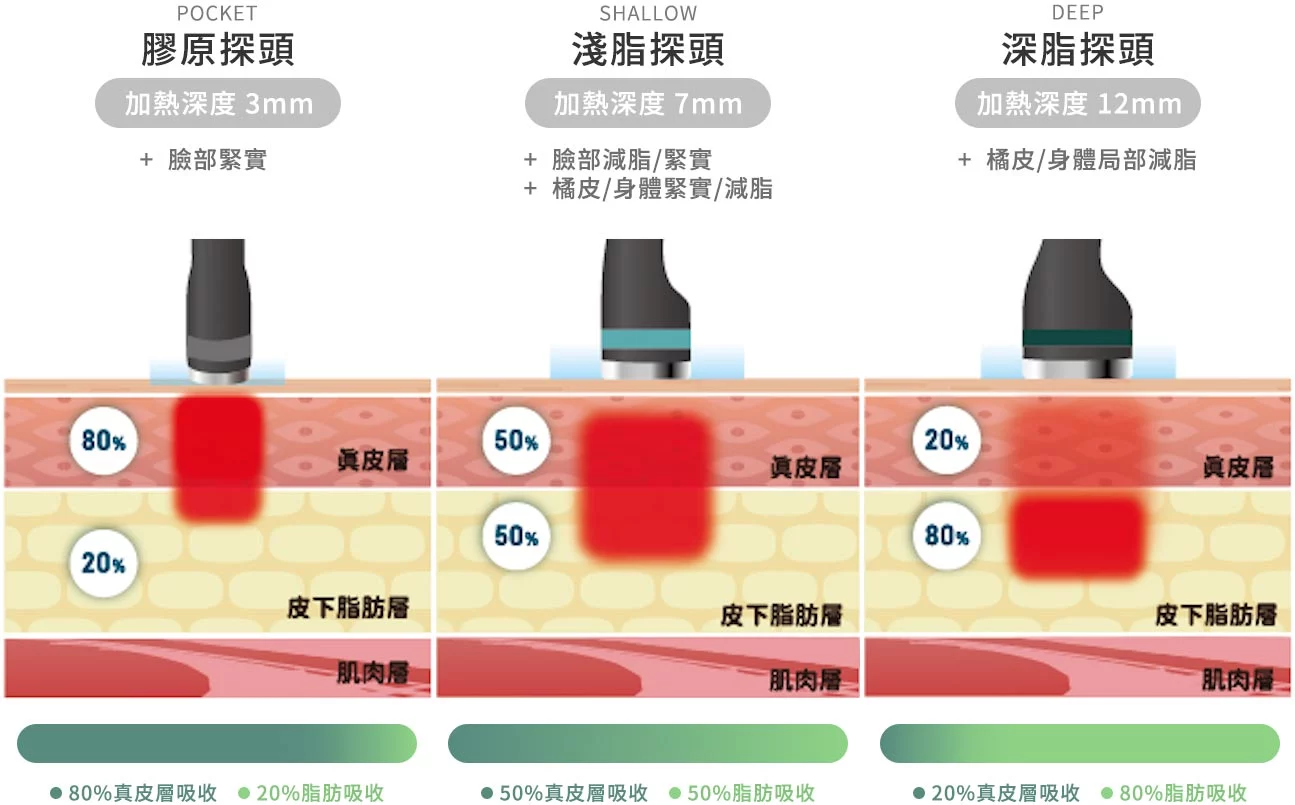 Onda PRO 三種探頭可客製化療程