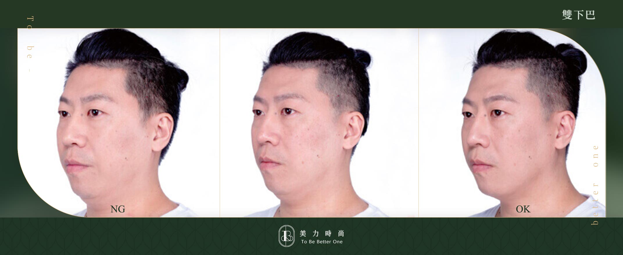 belkyra原廠提供案例