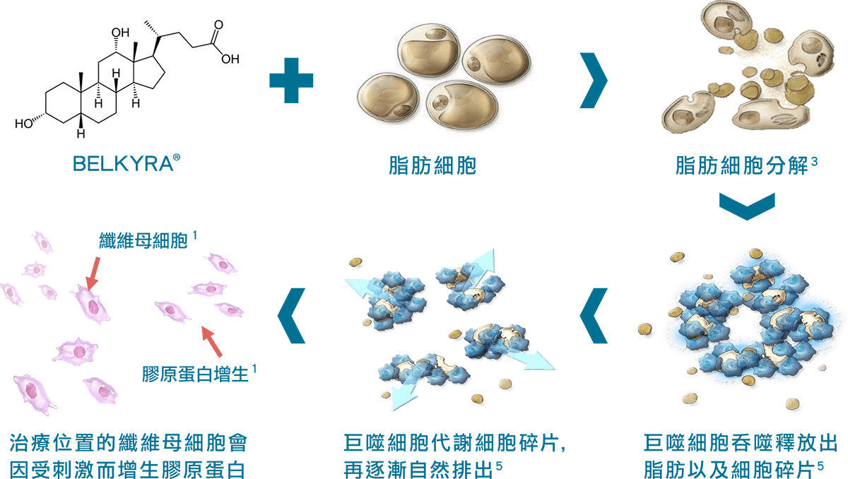 Belkyra倍克脂 機轉原理說明圖