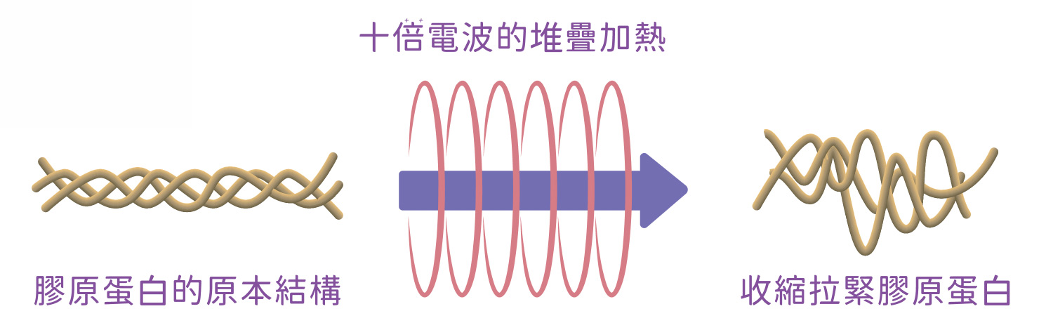 十蓓電波透過高頻率的單極電波能量，促使皮膚內膠原蛋白產生緊縮效應