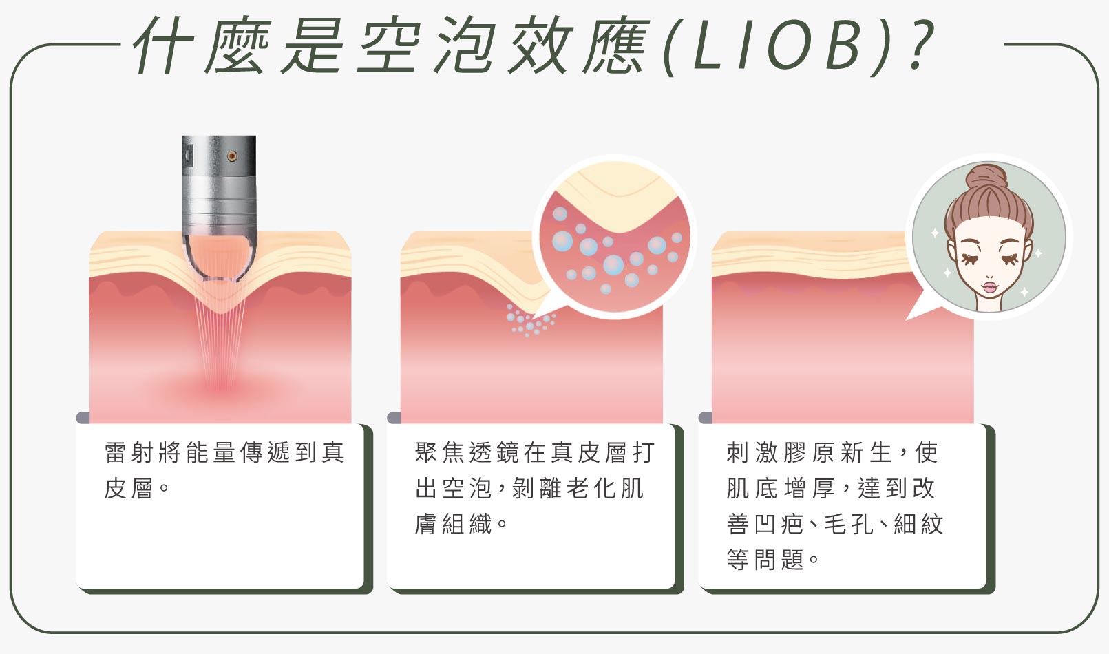 什麼是空泡效應？