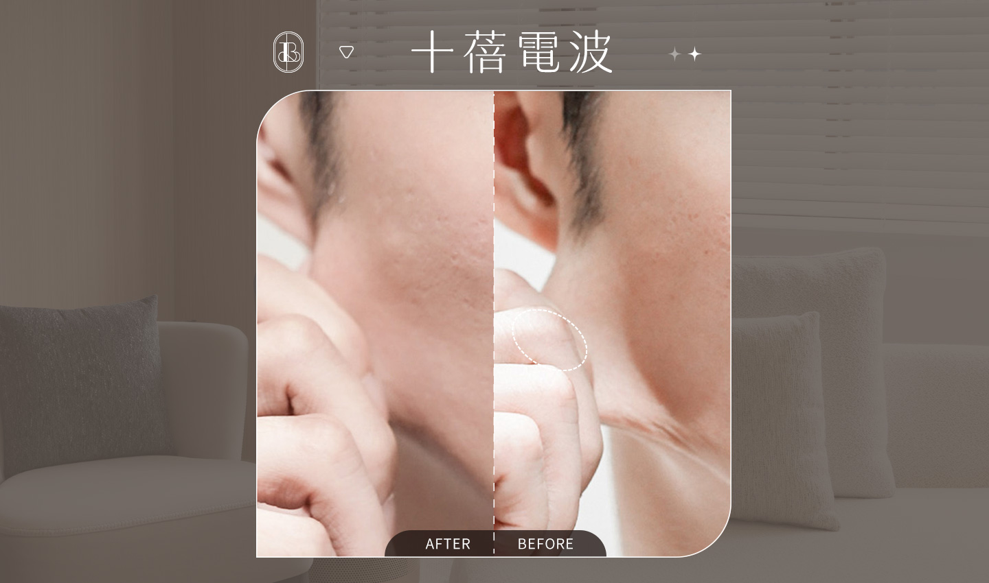 十蓓電波BA(500發)-勳狗