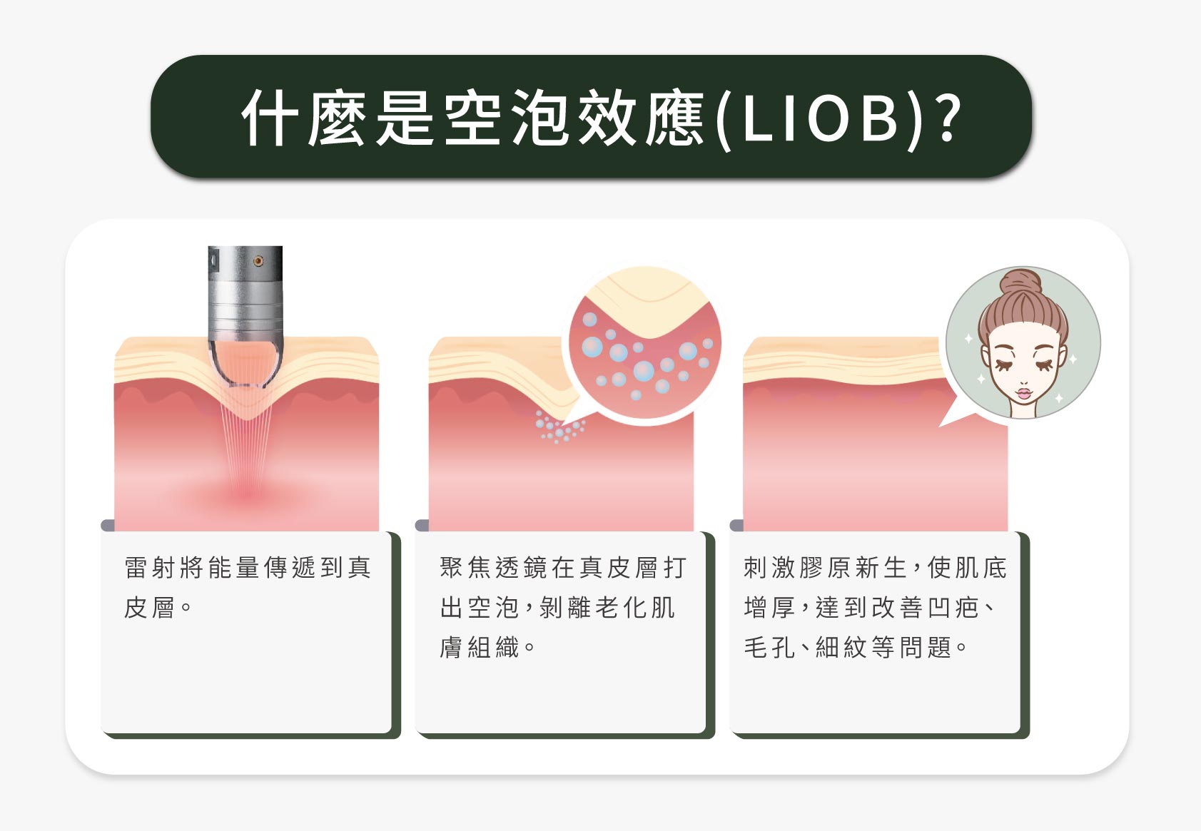 什麼是空泡效應(LIOB)？