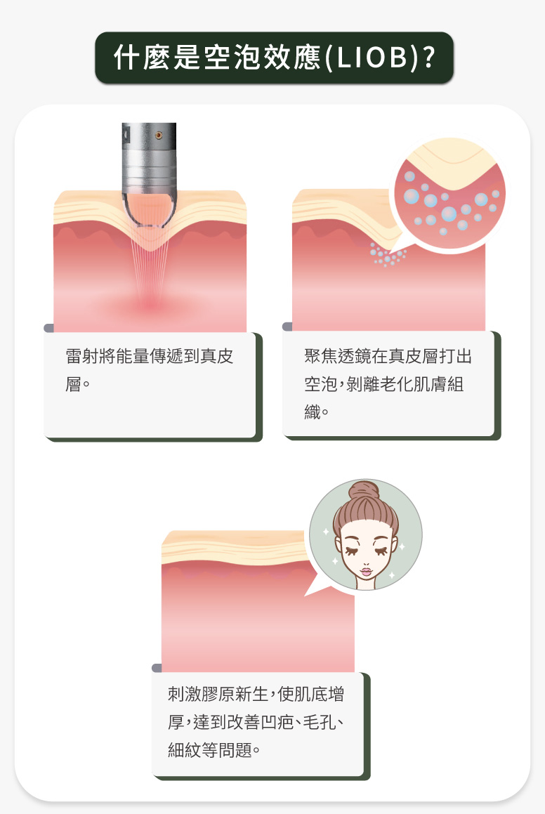 什麼是空泡效應(LIOB)？