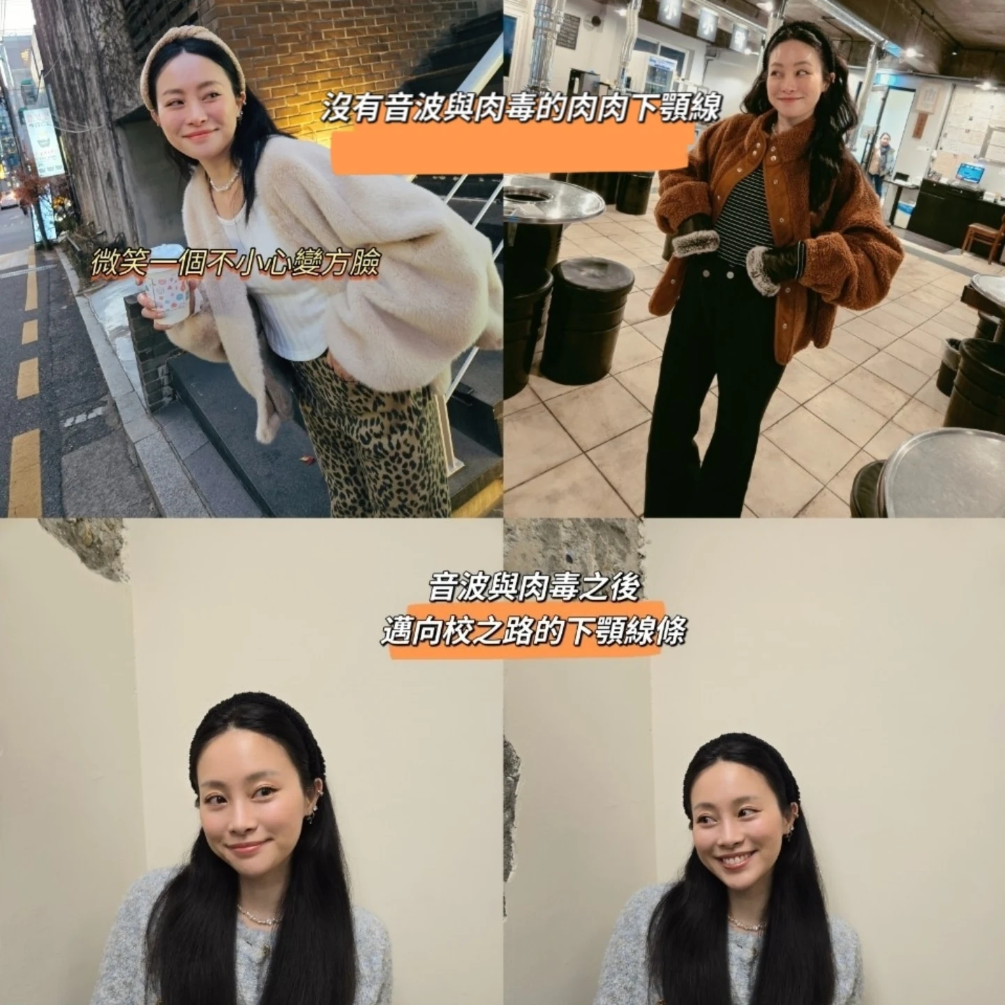 網紅《陳彤彤》肉毒咀嚼肌體驗心得分享