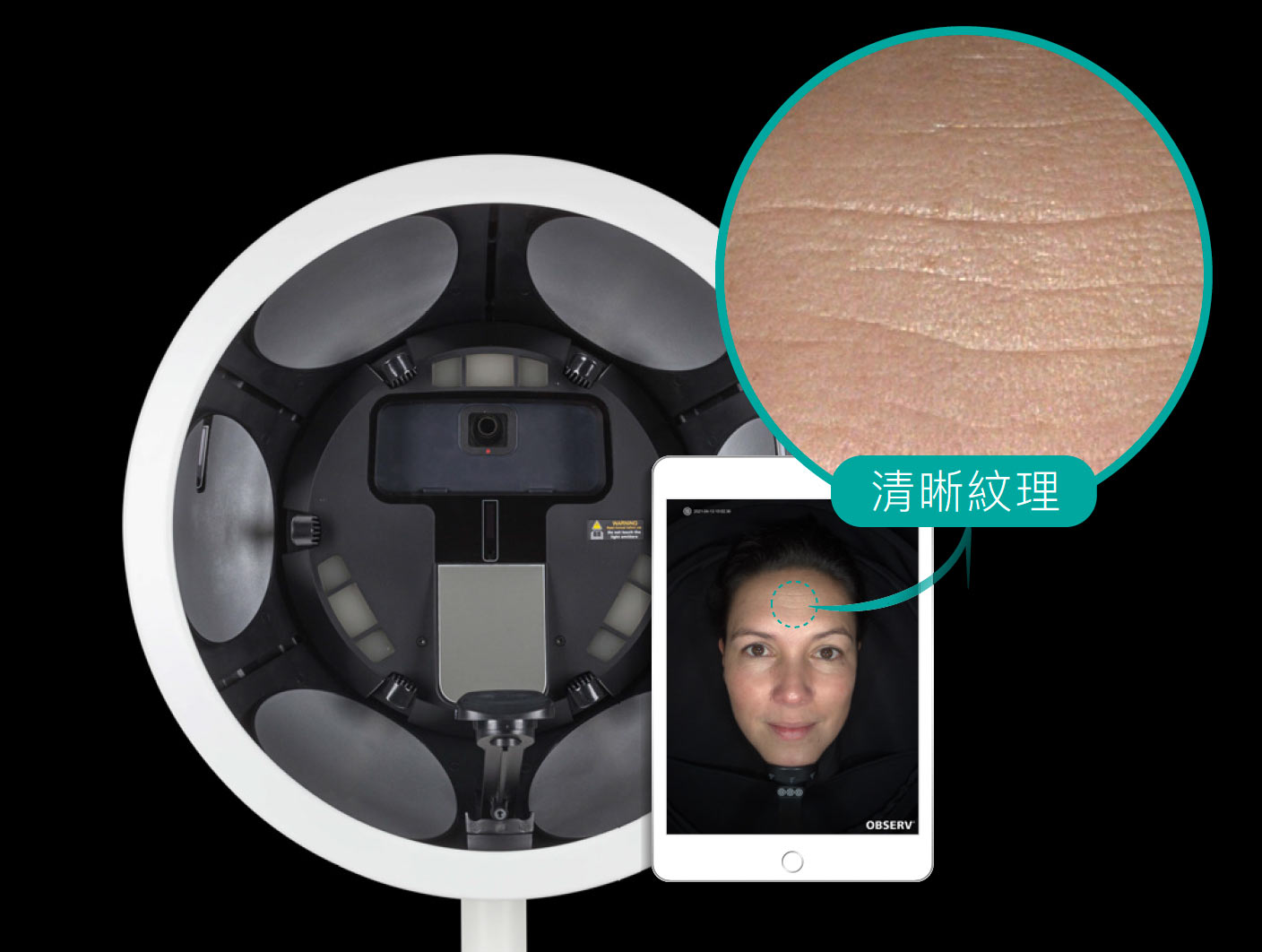 OBSERV 520x-高解析影像技術