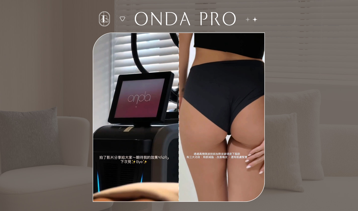 網紅《Kellybon》ONDA PRO超微波體驗心得分享~非侵入式體雕-大腿線條雕塑
