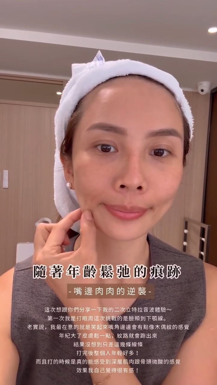 KOL沙莫太太最在意的臉部困擾是嘴邊肉、木偶紋