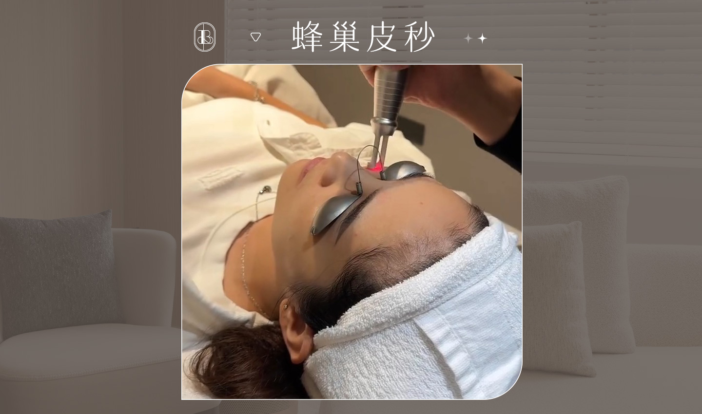 網紅《慕伊》蜂巢皮秒體驗心得分享