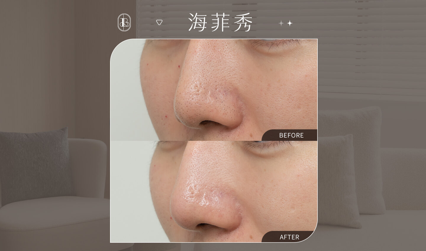 Dcard_孫元山won_海菲秀