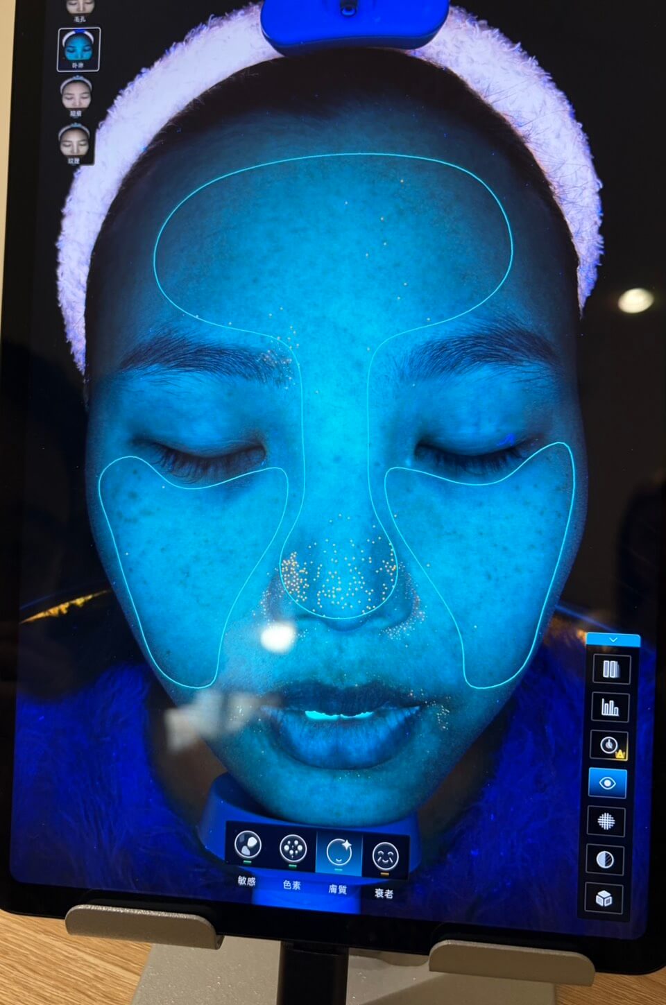 活力小胖妞 肌膚檢測