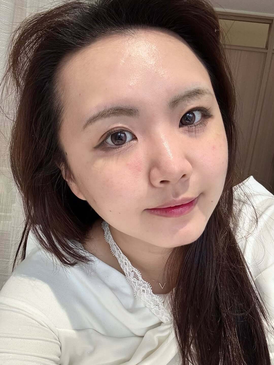 名妤剛做完海菲秀的狀態，原本乾燥無光的膚況也保濕透亮起來