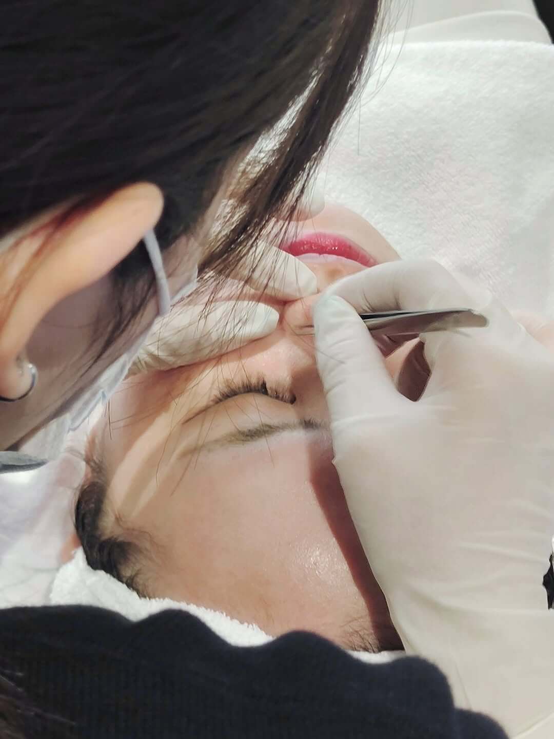 海菲秀步驟 手工清粉刺