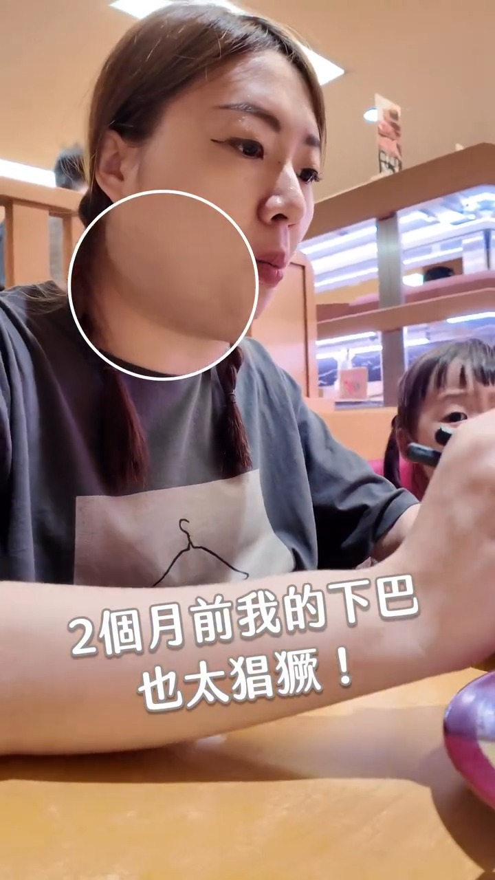 Livftyler莉芙太樂輪廓線改善前