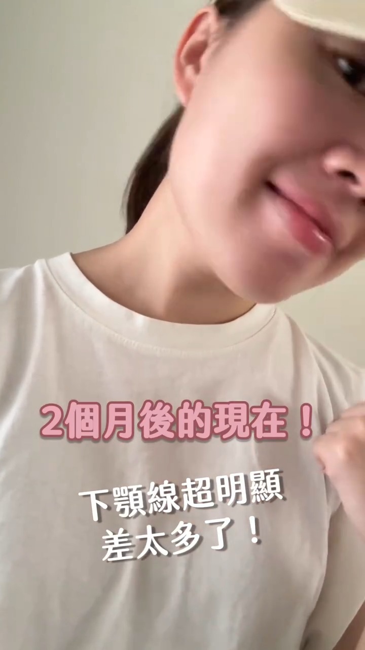 Livftyler莉芙太樂輪廓線做海芙音波媚必提改善後