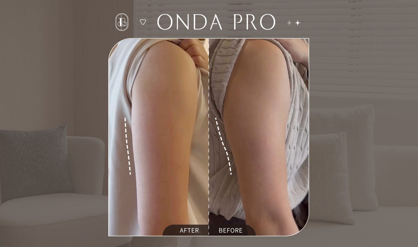 ONDA-PRO-手臂BA