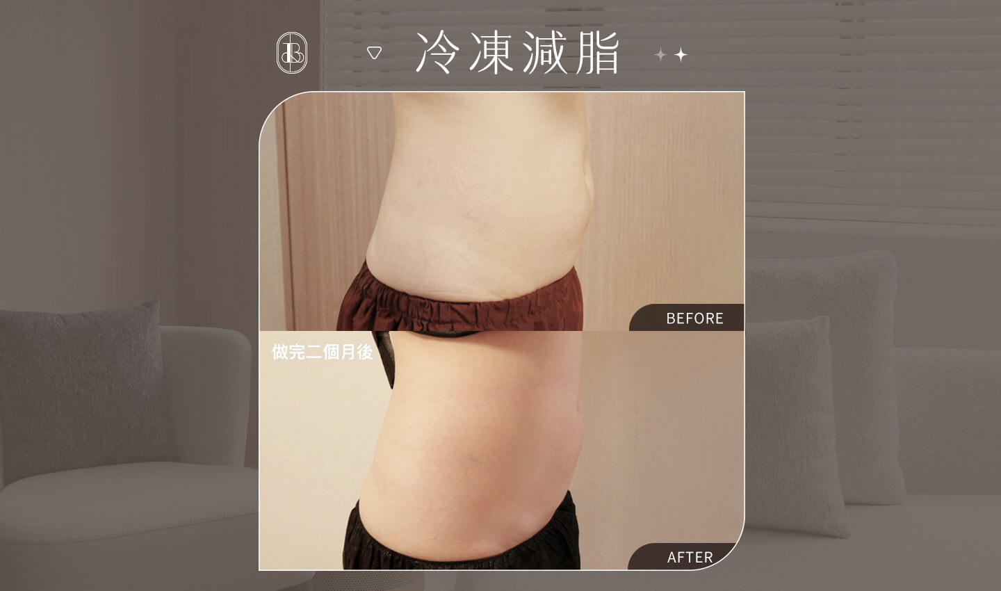 冷凍減脂-肚子BA