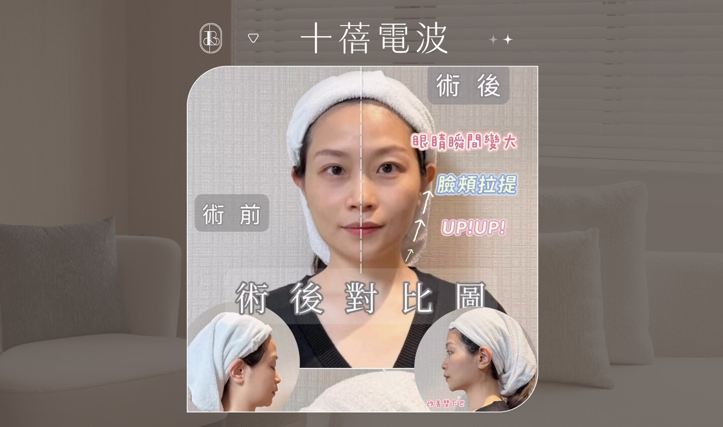 十蓓電波KOL體驗分享BA