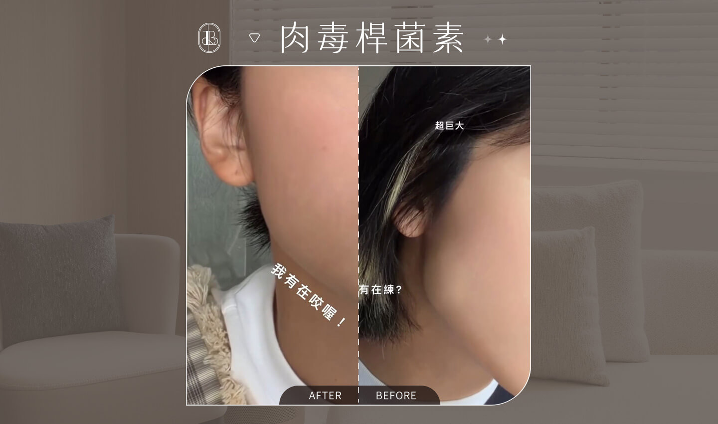 奇蹟肉毒BA-睡睡子