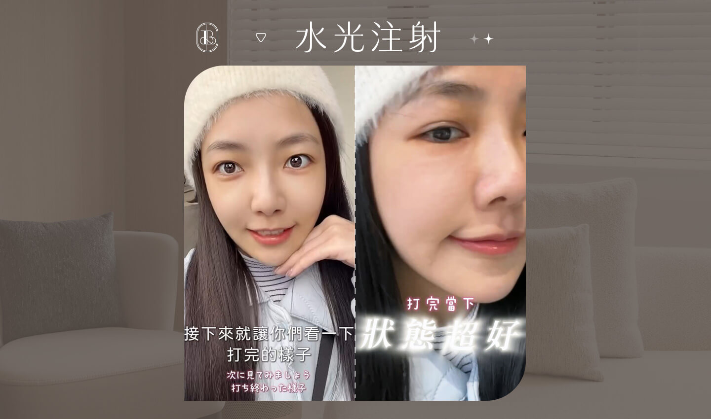 水光針KOL體驗