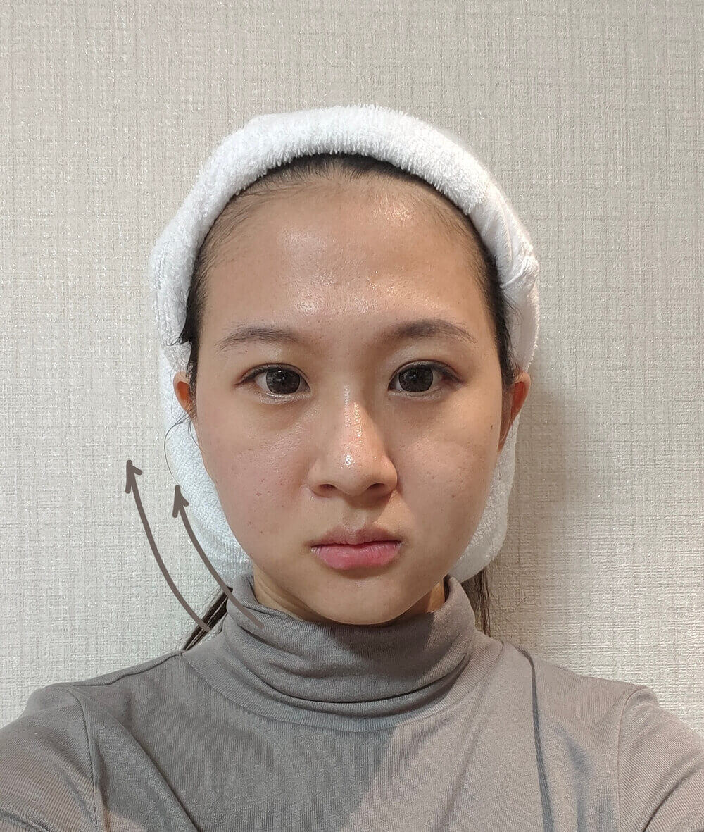 海芙電波施做完當下BA