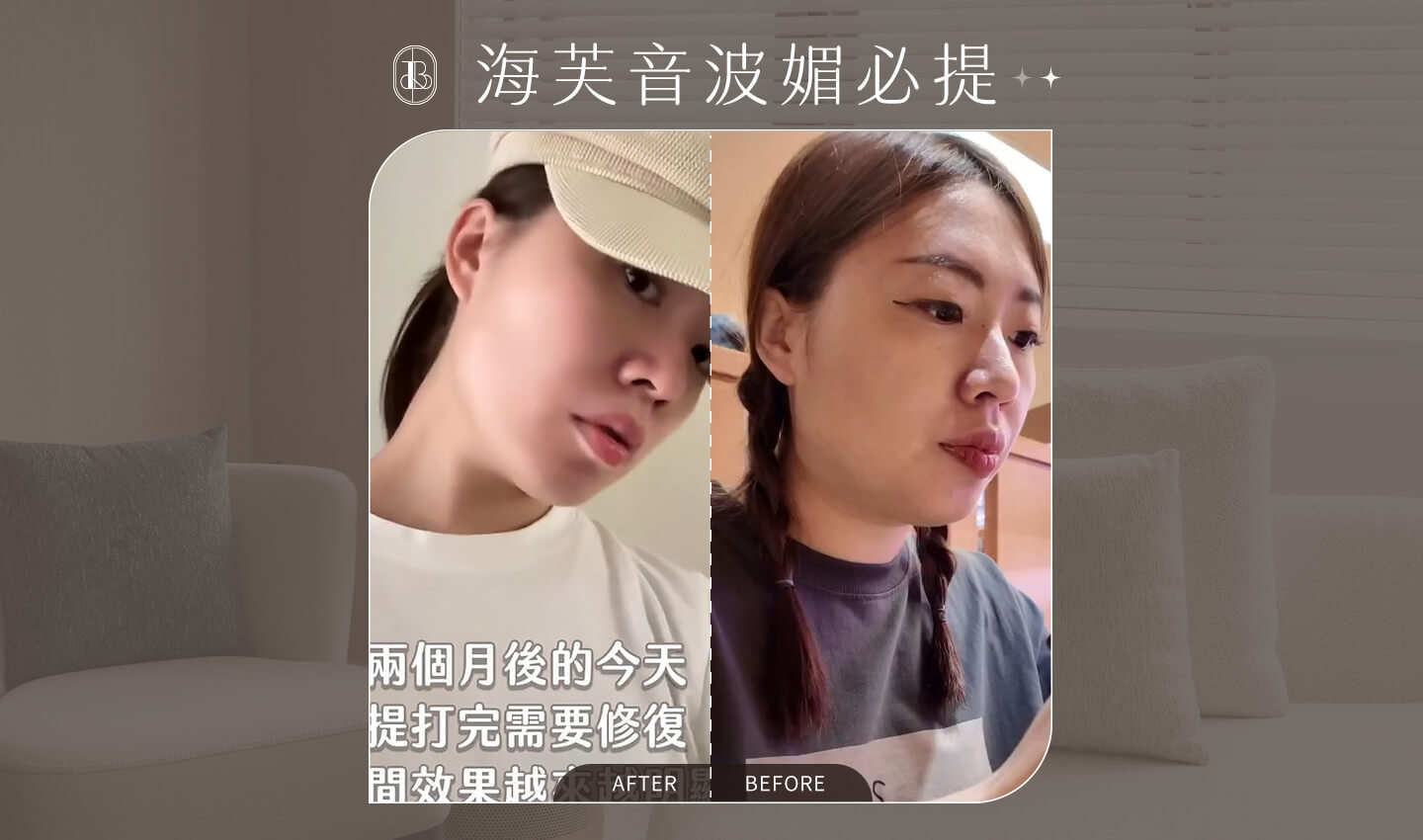 Livftyler莉芙太樂_體驗海芙音波媚必提後的BA照