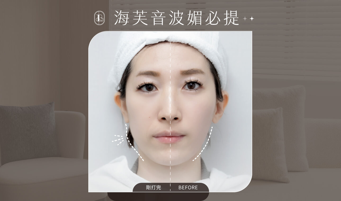 莎媽_體驗海芙音波媚必提後的BA照