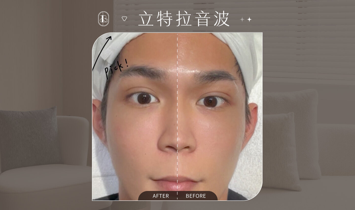 立特拉音波眼周拉提-勳狗