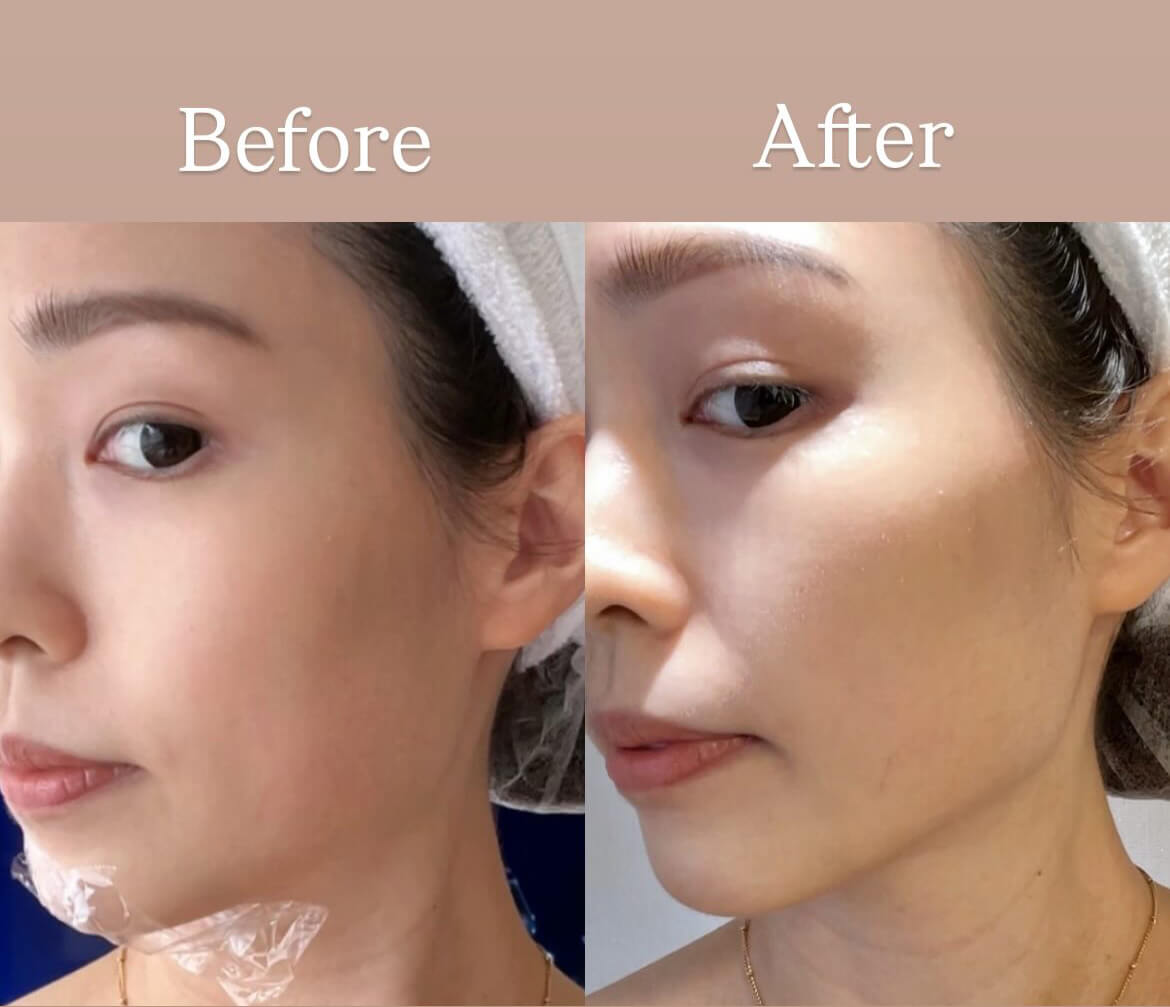 立特拉音波BA-楊晴