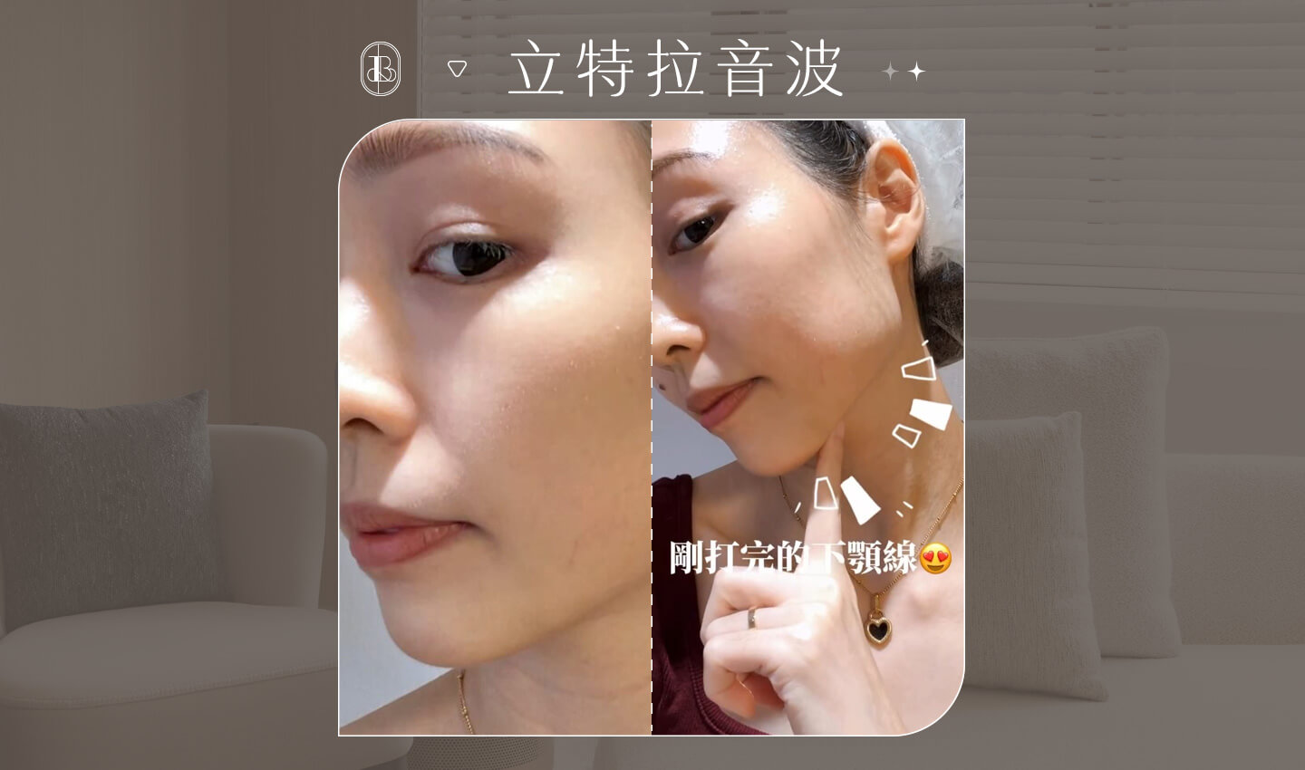 立特拉音波-KOL楊晴