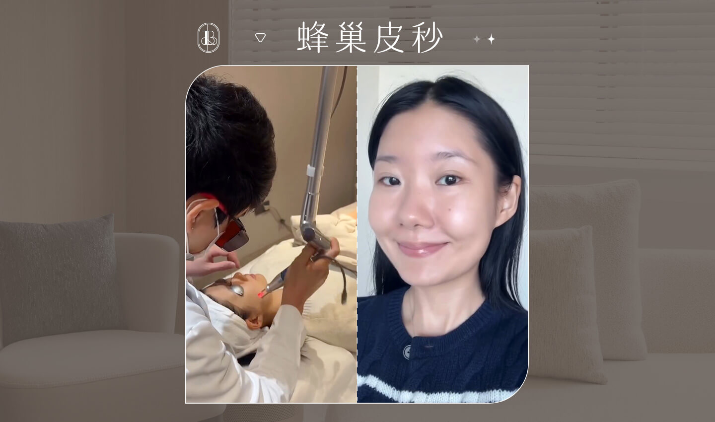 蜂巢皮秒-Angela-cover