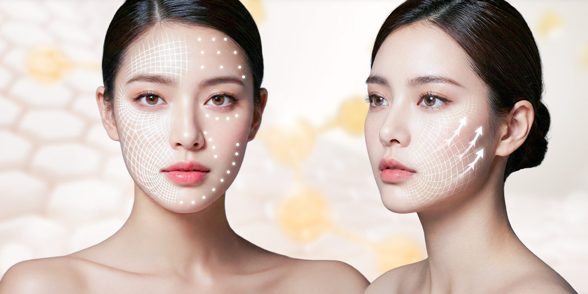 醫美複合式療程：能量X注射 OR 能量X線材