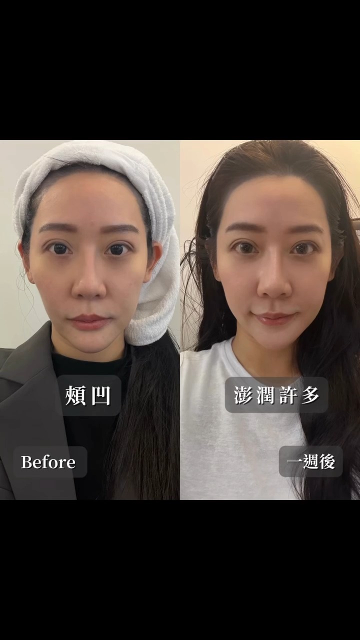 十蓓電波-潘森森BA