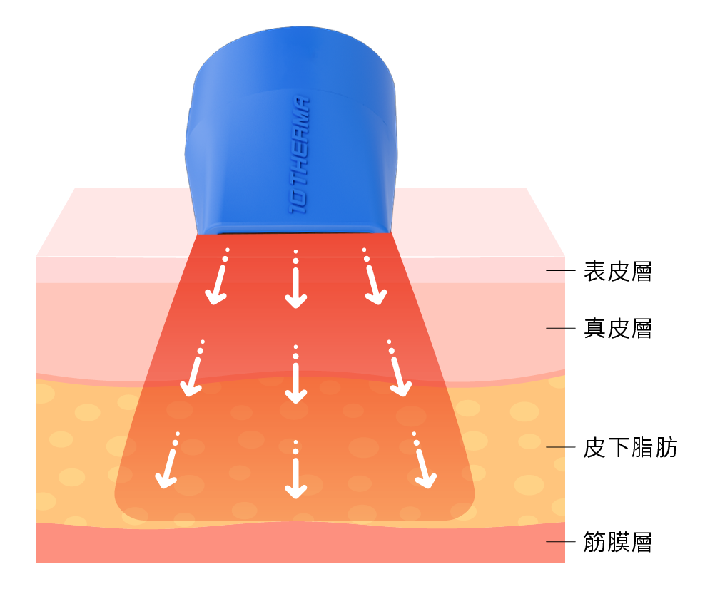 十蓓電波_藍色探頭_單極