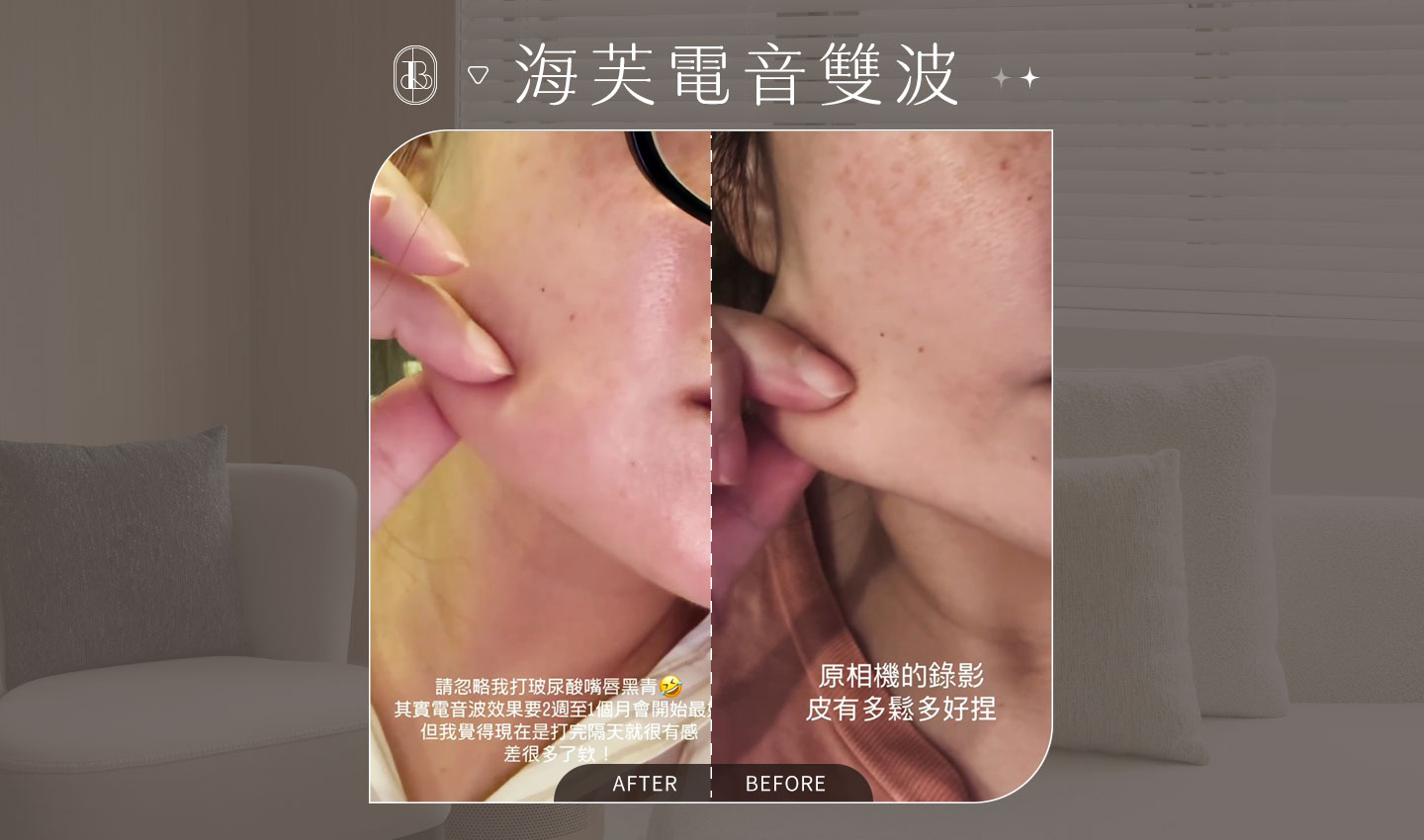 海芙電音雙波BA-Aiko