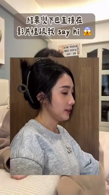 KOL李文WENWEN施打立特拉音波前，有雙下巴、輪廓線模糊的困擾