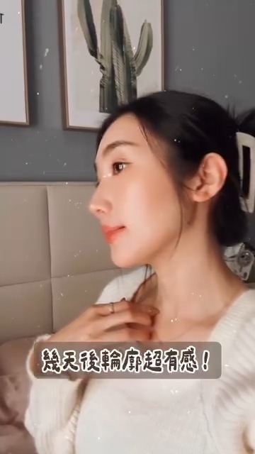 KOL李文WENWEN施打立特拉音波後輪廓的改變