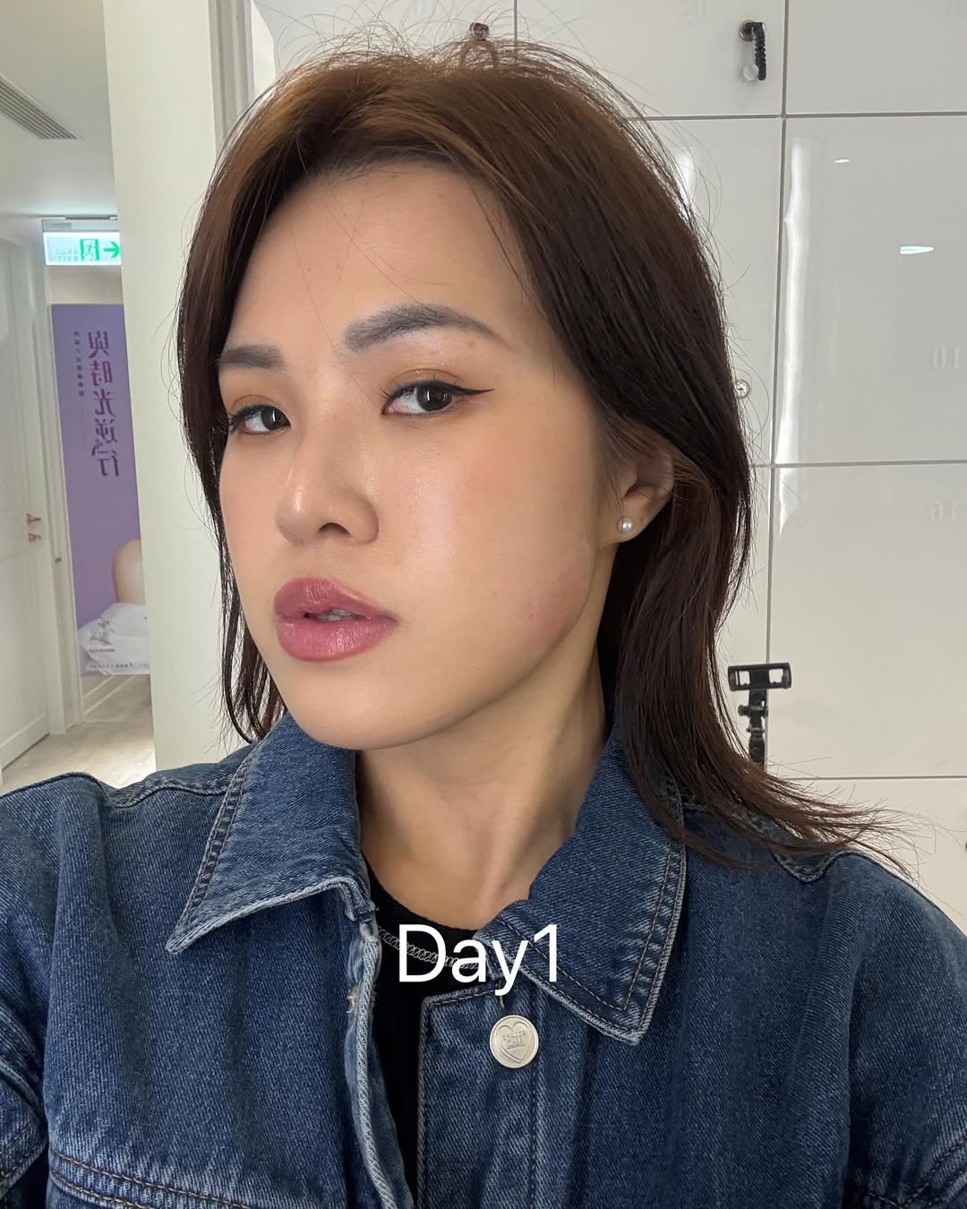 肉毒小臉-Blair-DAY1