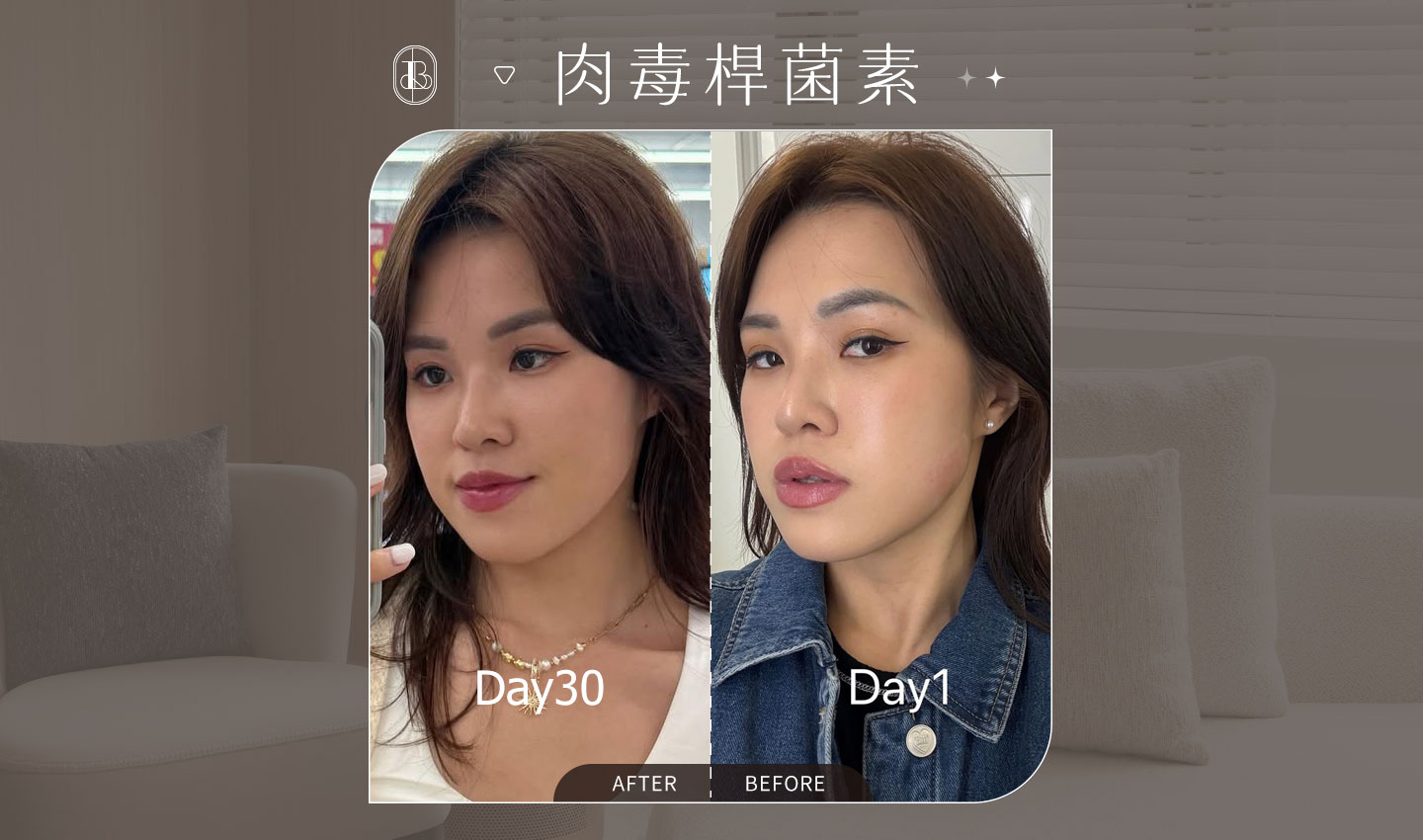 肉毒小臉BA-Blair