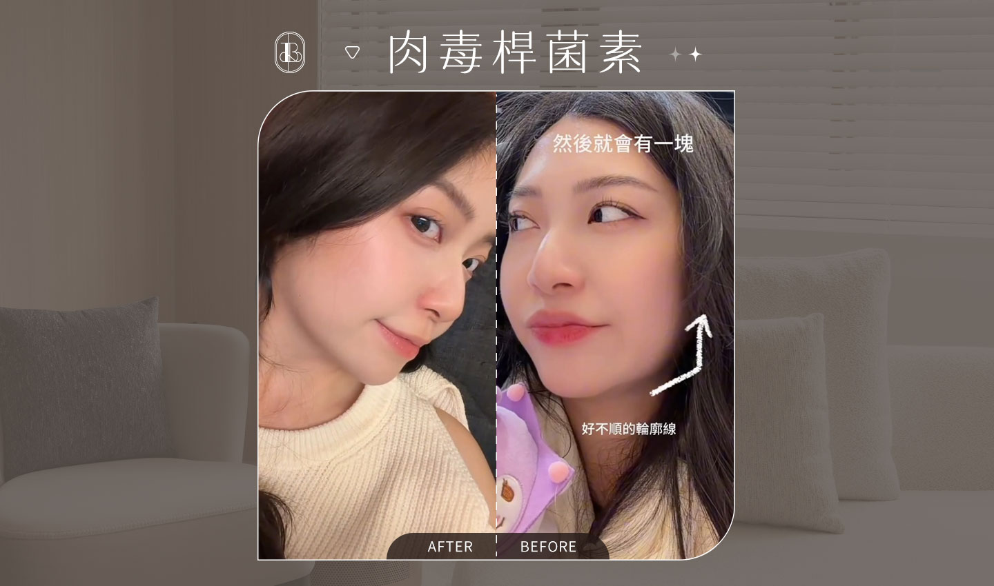 肉毒小臉-宋米樂BA