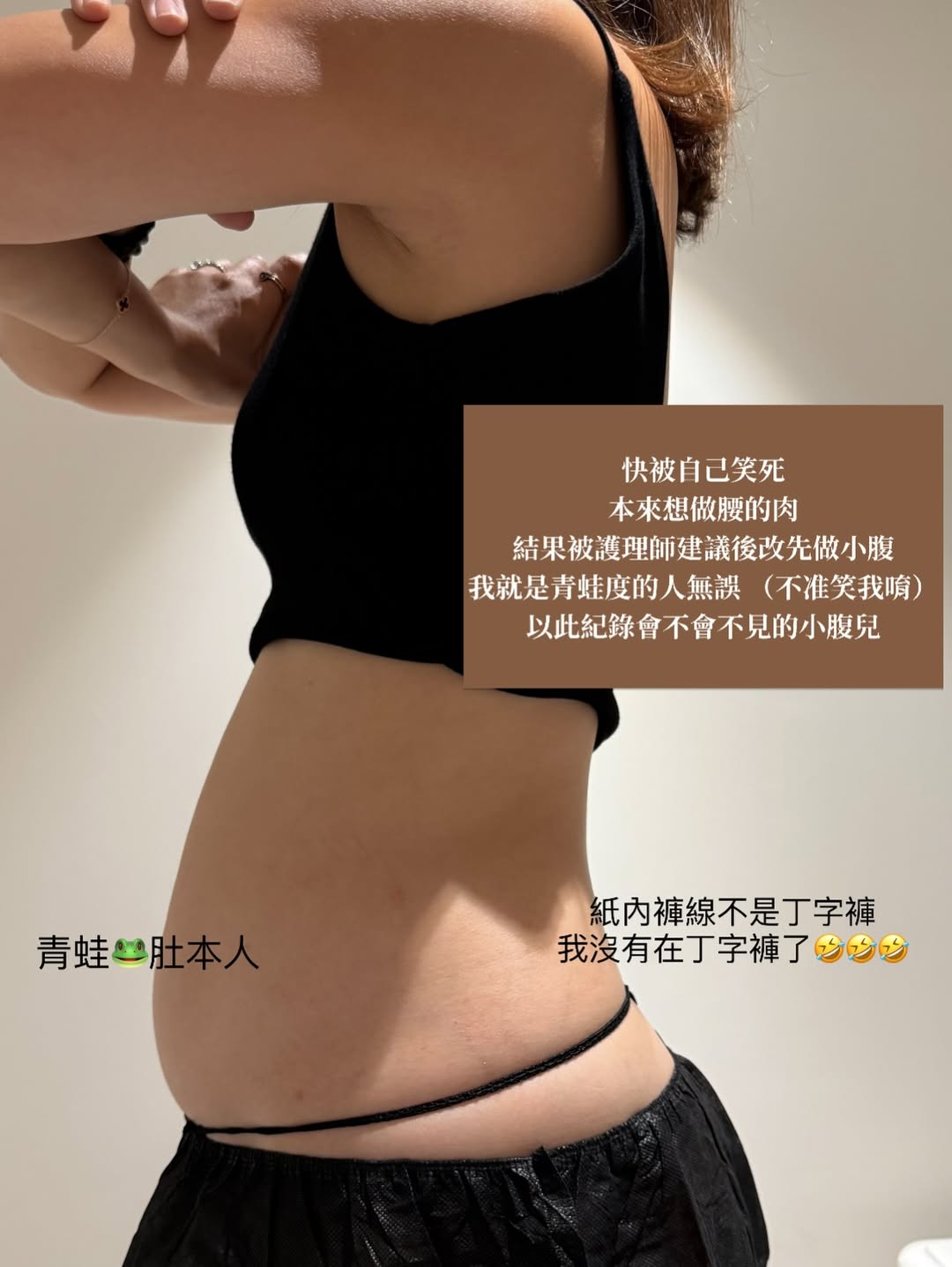 阿爾發冷凍減脂-沙莫太太Before