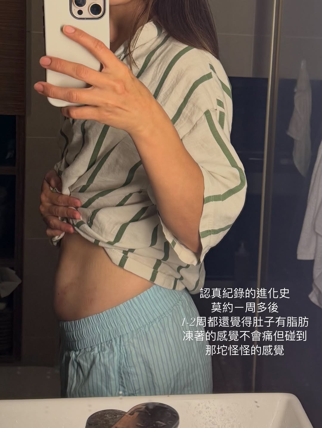 阿爾發冷凍減脂-沙莫太太after3周