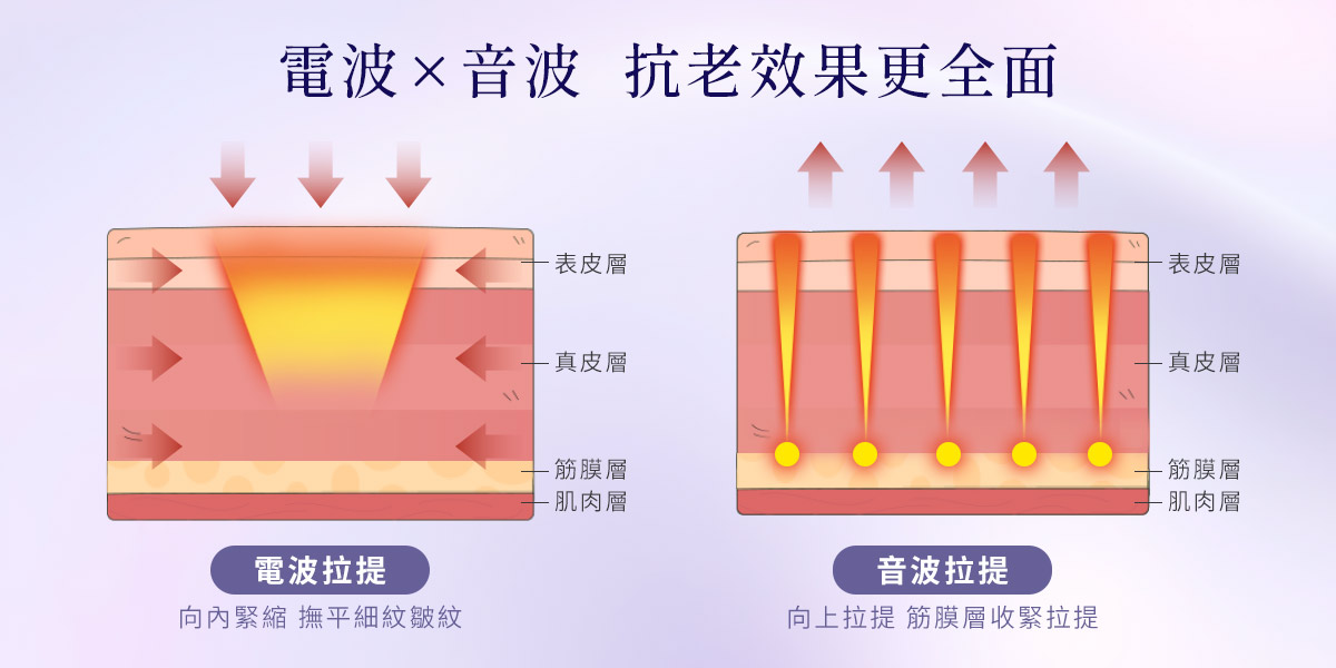 電波x音波 抗老更全面