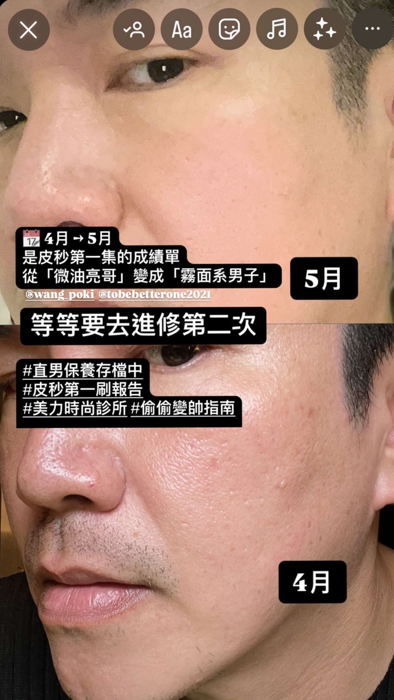 KOL阿丹-第一次BA