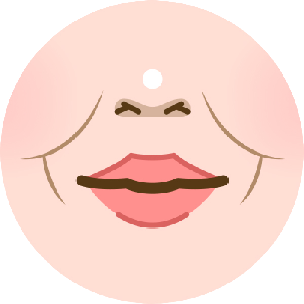 骨骼型法令紋：多與骨架結構、脂肪支撐不足有關，例如鼻基底凹陷，中臉支撐不足，不笑時鼻翼兩側三角區塊也會有陰影感